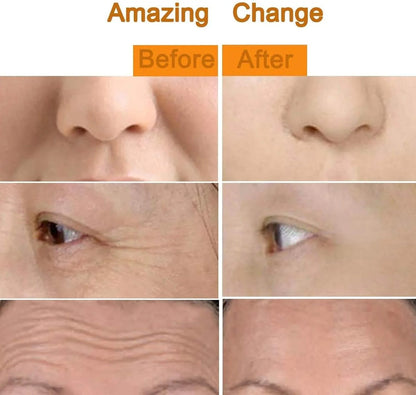 24K Gold Energy Beauty Bar – Electric Facial Massage Roller